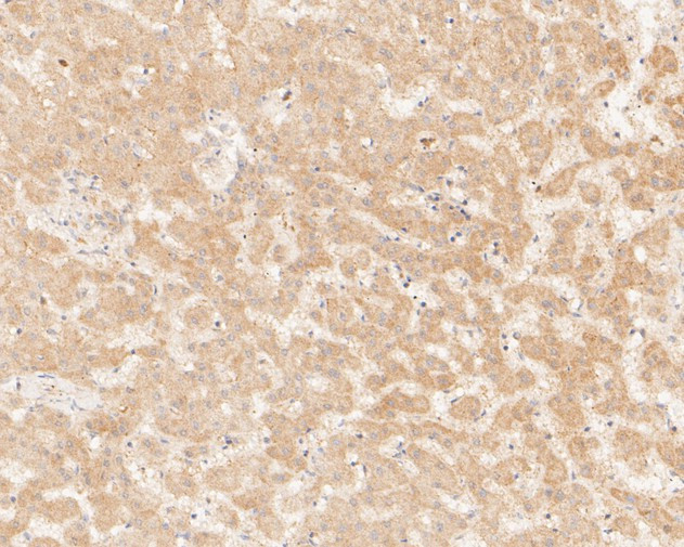 KIFAP3 Antibody in Immunohistochemistry (Paraffin) (IHC (P))