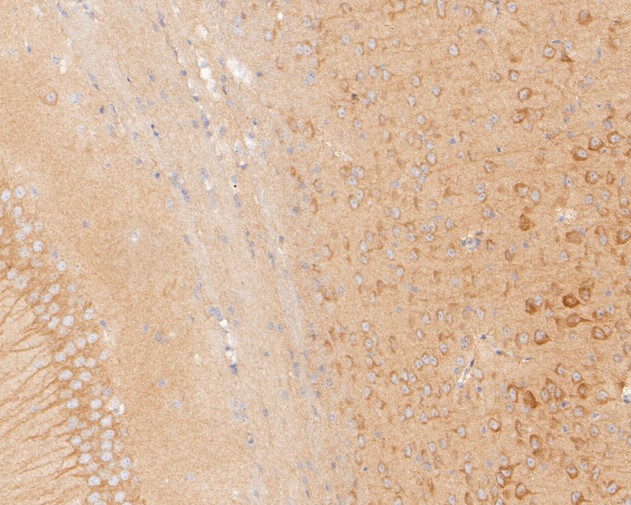 KIFAP3 Antibody in Immunohistochemistry (Paraffin) (IHC (P))