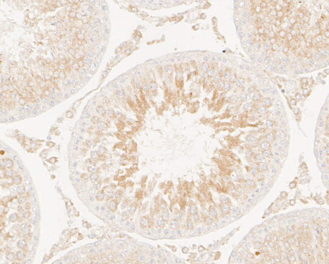 KIFAP3 Antibody in Immunohistochemistry (Paraffin) (IHC (P))