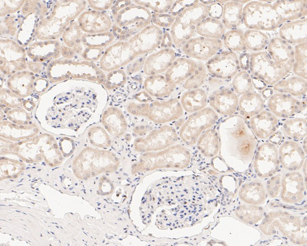 SENP2 Antibody in Immunohistochemistry (Paraffin) (IHC (P))