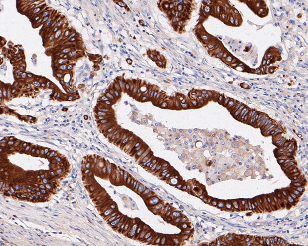 SLC22A3 Antibody in Immunohistochemistry (Paraffin) (IHC (P))