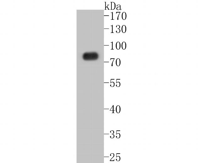 SLC22A3 Antibody in Western Blot (WB)