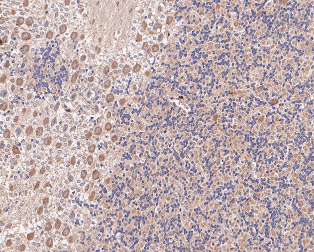 eIF3b Antibody in Immunohistochemistry (Paraffin) (IHC (P))