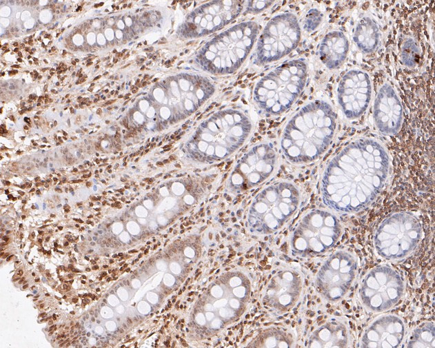 eIF3e Antibody in Immunohistochemistry (Paraffin) (IHC (P))