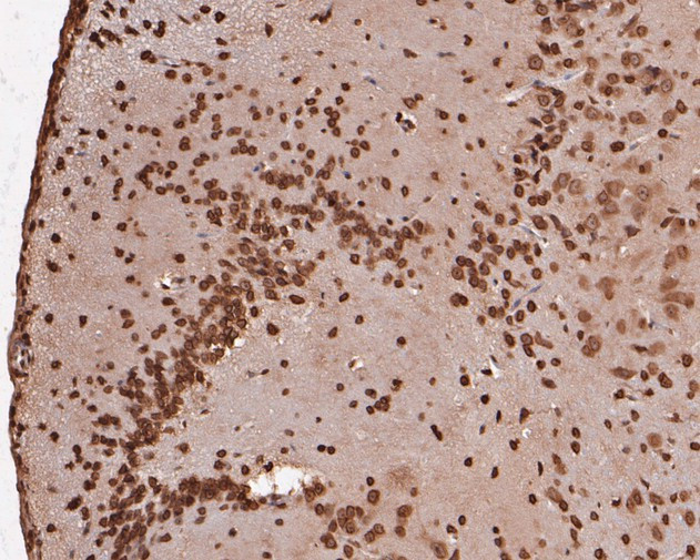 eIF3e Antibody in Immunohistochemistry (Paraffin) (IHC (P))