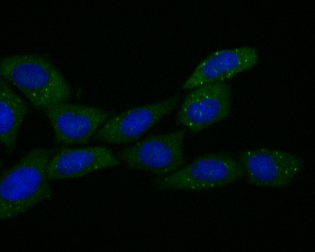 ECM1 Antibody in Immunocytochemistry (ICC/IF)