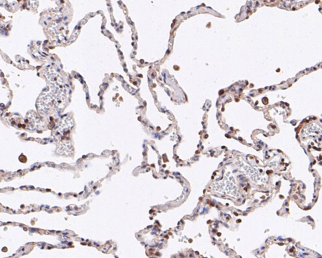 ABI2 Antibody in Immunohistochemistry (Paraffin) (IHC (P))