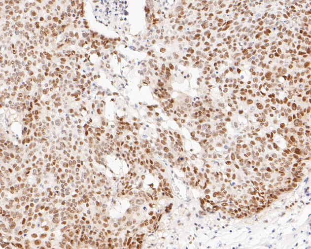 DP1 Antibody in Immunohistochemistry (Paraffin) (IHC (P))