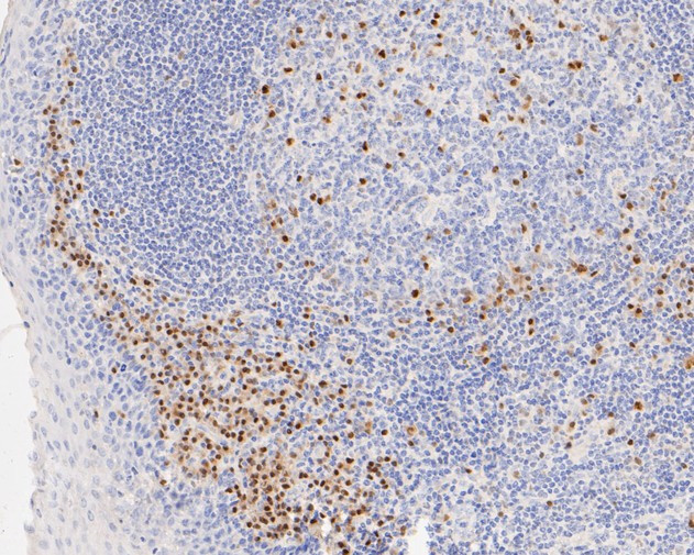 MUM1 Antibody in Immunohistochemistry (Paraffin) (IHC (P))