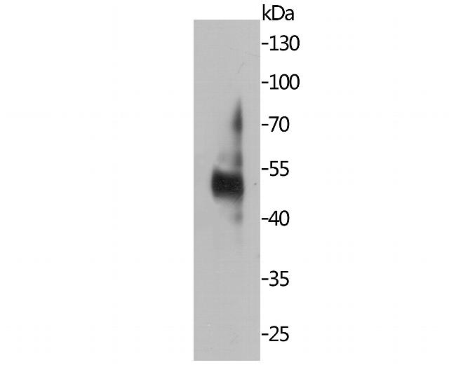 MUM1 Antibody in Western Blot (WB)