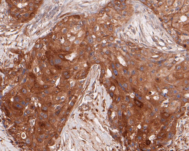 ARF5 Antibody in Immunohistochemistry (Paraffin) (IHC (P))