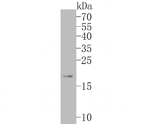 ARF5 Antibody in Western Blot (WB)