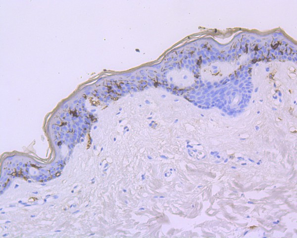 CD1a Antibody in Immunohistochemistry (Paraffin) (IHC (P))