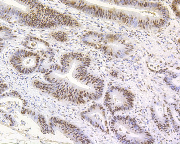 MSH2 Antibody in Immunohistochemistry (Paraffin) (IHC (P))