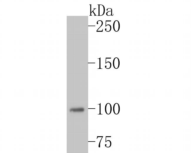 MSH2 Antibody in Western Blot (WB)