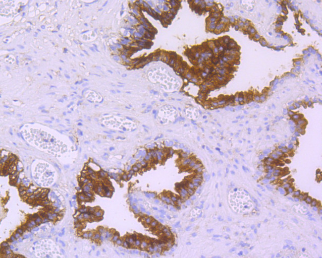 CD38 Antibody in Immunohistochemistry (Paraffin) (IHC (P))