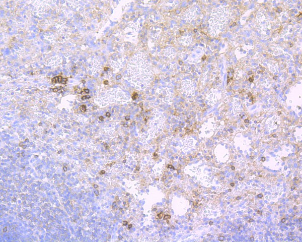 CD38 Antibody in Immunohistochemistry (Paraffin) (IHC (P))