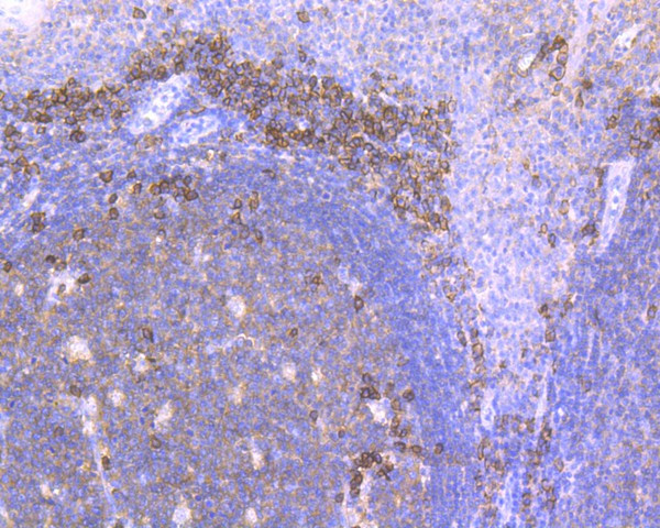 CD38 Antibody in Immunohistochemistry (Paraffin) (IHC (P))