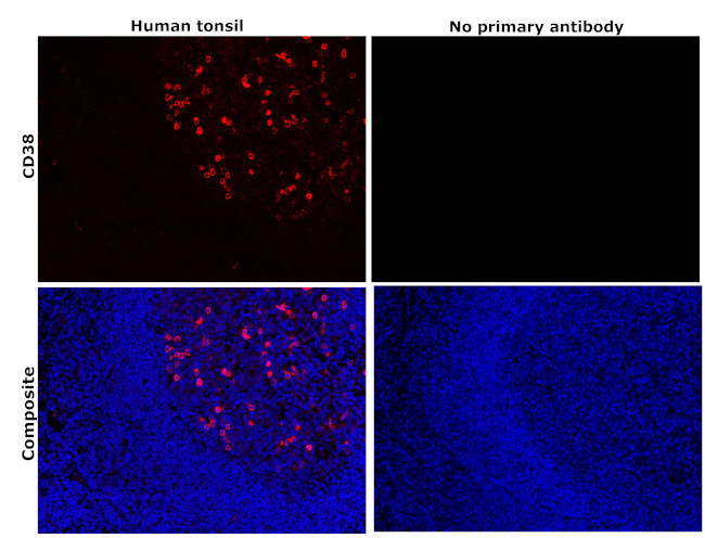 CD38 Antibody in Immunohistochemistry (Paraffin) (IHC (P))