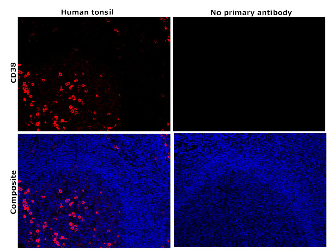 CD38 Antibody in Immunohistochemistry (Paraffin) (IHC (P))