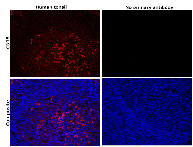 CD38 Antibody in Immunohistochemistry (Paraffin) (IHC (P))