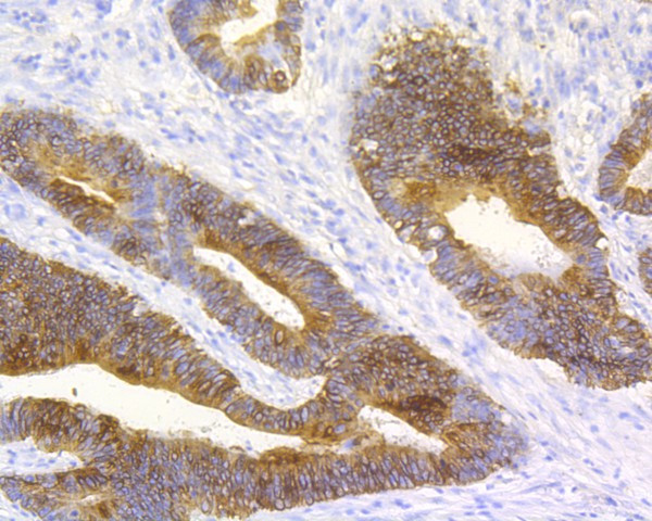 Cytokeratin 20 Antibody in Immunohistochemistry (Paraffin) (IHC (P))