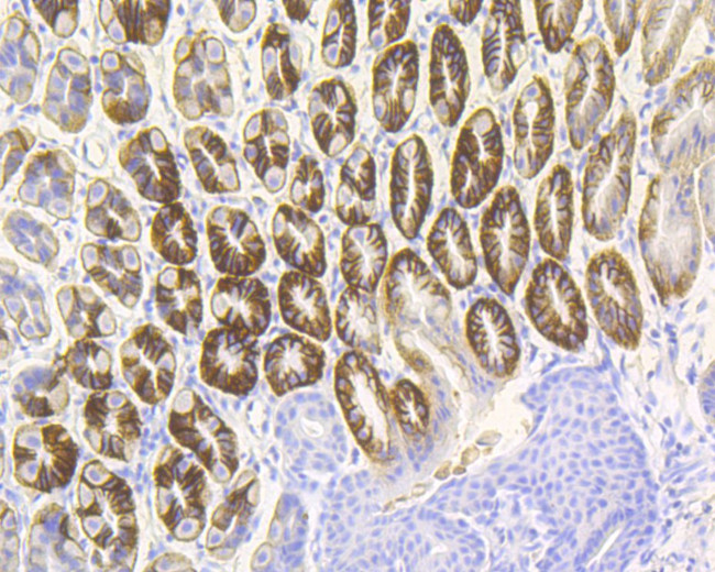 Cytokeratin 20 Antibody in Immunohistochemistry (Paraffin) (IHC (P))