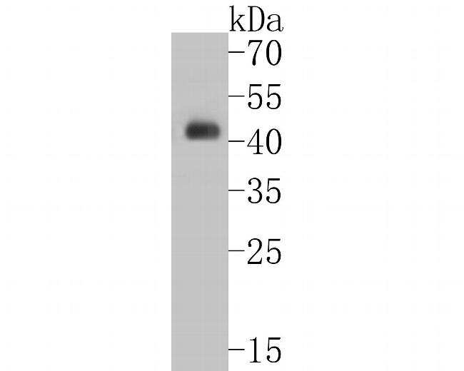 Cytokeratin 20 Antibody in Western Blot (WB)