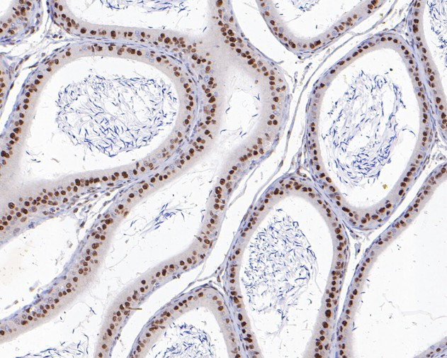 PAX2 Antibody in Immunohistochemistry (Paraffin) (IHC (P))