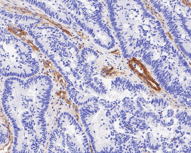 Integrin beta 3 Antibody in Immunohistochemistry (Paraffin) (IHC (P))