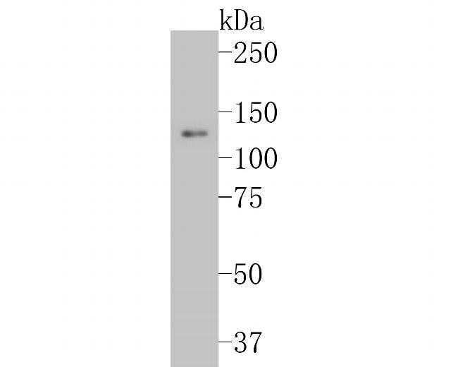 Integrin beta 3 Antibody in Western Blot (WB)