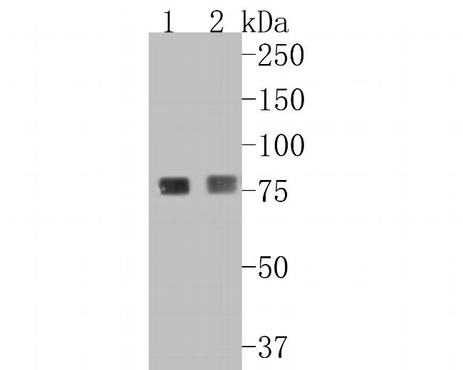 beta glucuronidase Antibody in Western Blot (WB)