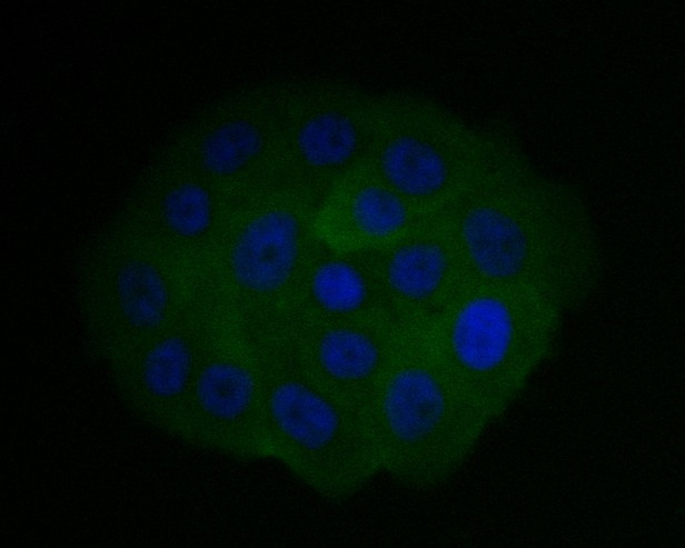 CHMP2B Antibody in Immunocytochemistry (ICC/IF)