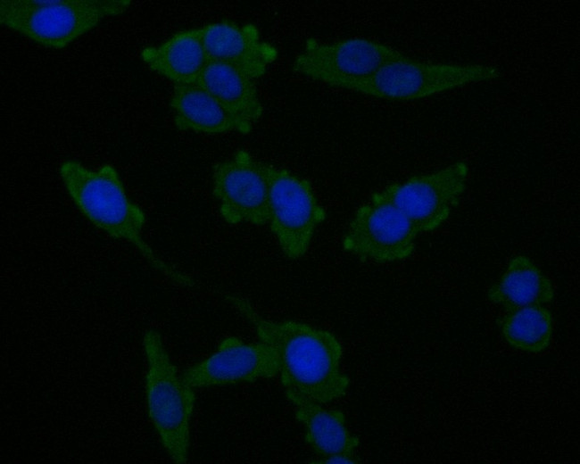 CHMP2B Antibody in Immunocytochemistry (ICC/IF)