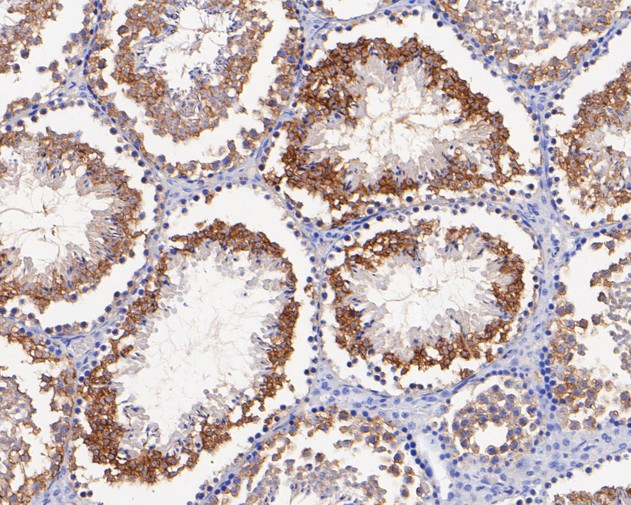 CHMP2B Antibody in Immunohistochemistry (Paraffin) (IHC (P))