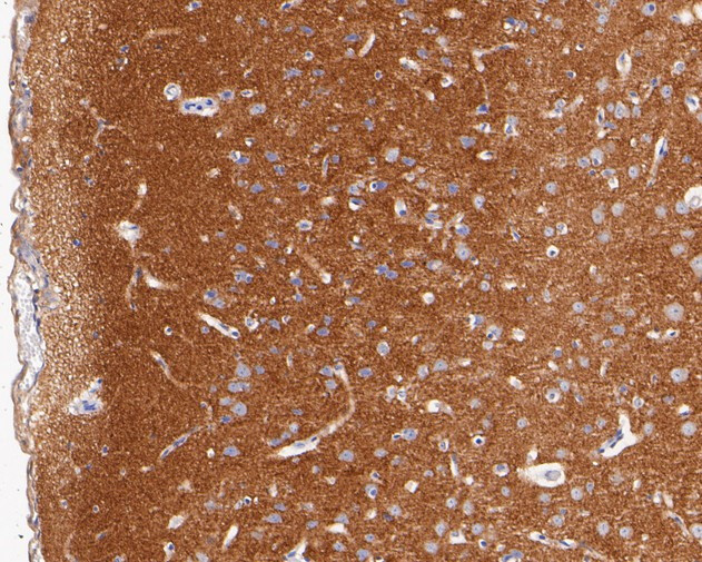 Syntaxin 1 Antibody in Immunohistochemistry (Paraffin) (IHC (P))