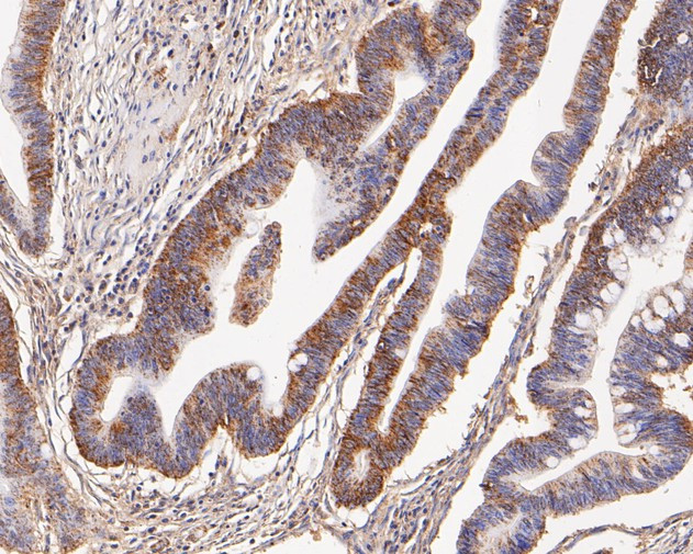 GOT2 Antibody in Immunohistochemistry (Paraffin) (IHC (P))