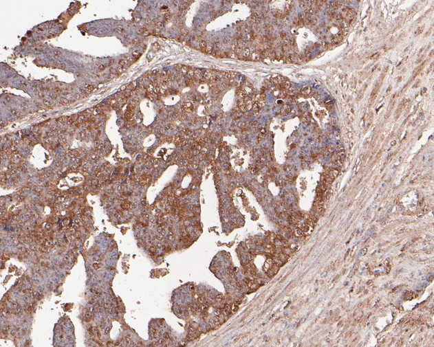 TNFRSF19 Antibody in Immunohistochemistry (Paraffin) (IHC (P))