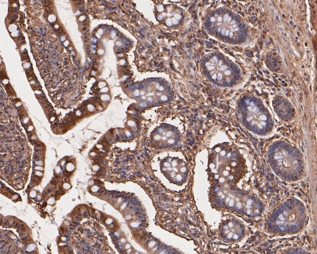 TNFRSF19 Antibody in Immunohistochemistry (Paraffin) (IHC (P))