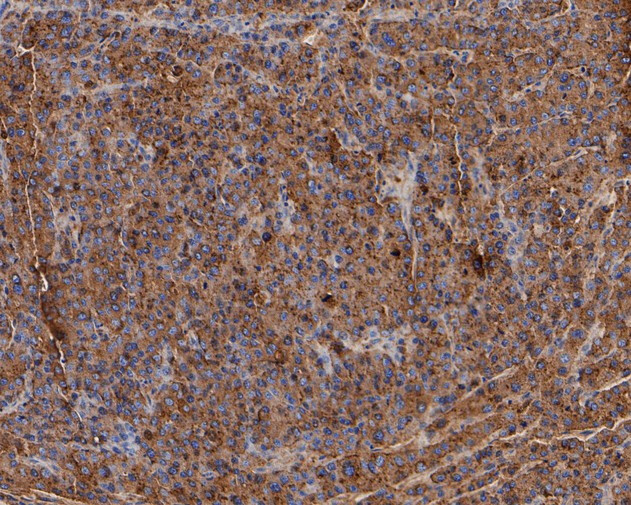 GAA Antibody in Immunohistochemistry (Paraffin) (IHC (P))