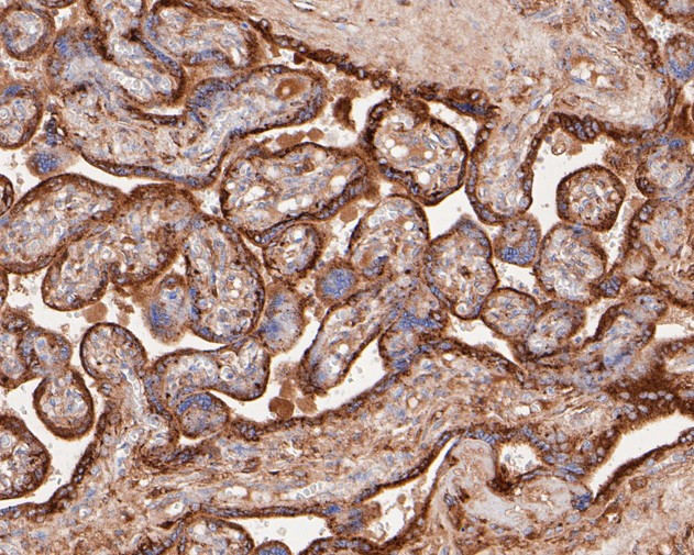 GAA Antibody in Immunohistochemistry (Paraffin) (IHC (P))