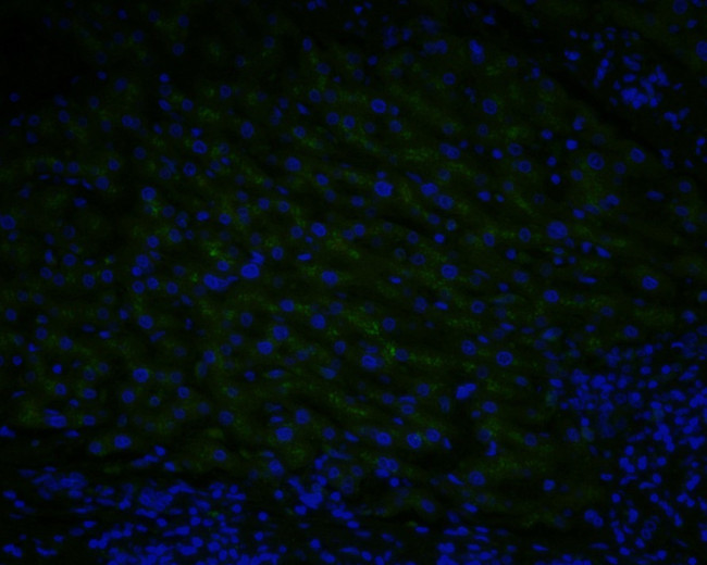 GAA Antibody in Immunohistochemistry (Paraffin) (IHC (P))