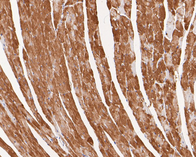 VEGFD Antibody in Immunohistochemistry (Paraffin) (IHC (P))