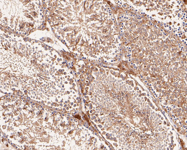 VEGFD Antibody in Immunohistochemistry (Paraffin) (IHC (P))