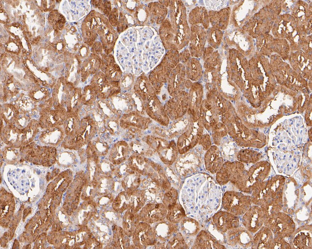 VEGFD Antibody in Immunohistochemistry (Paraffin) (IHC (P))