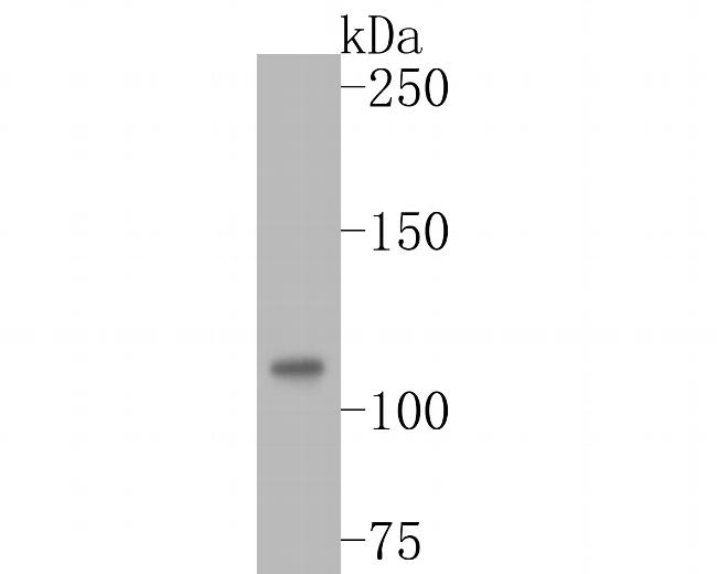 DPYD Antibody in Western Blot (WB)