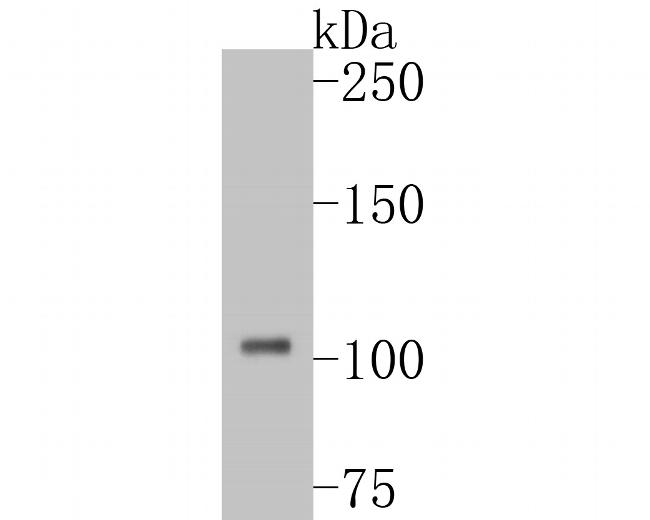 DPYD Antibody in Western Blot (WB)