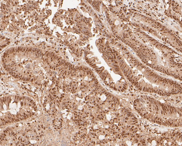 NFYA Antibody in Immunohistochemistry (Paraffin) (IHC (P))