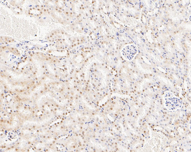 NFYA Antibody in Immunohistochemistry (Paraffin) (IHC (P))
