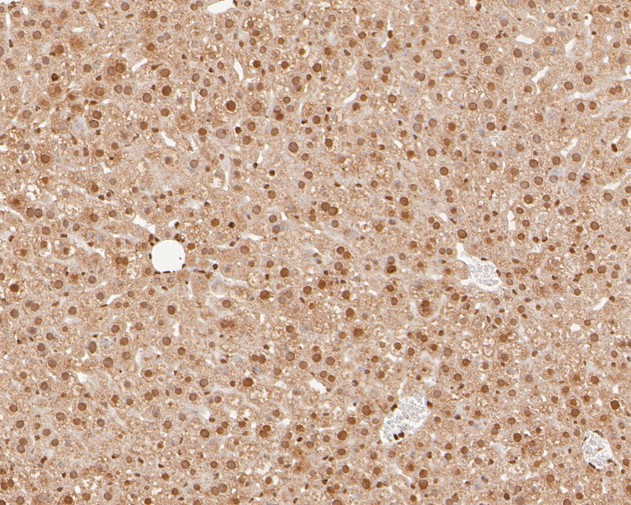 NFYA Antibody in Immunohistochemistry (Paraffin) (IHC (P))